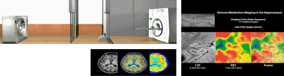 HIGH RESOLUTION PET/MRI FUSION SYSTEM 이미지